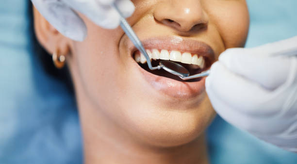 Best Emergency Dental Care for Broken or Chipped Teeth in Stockton, CA